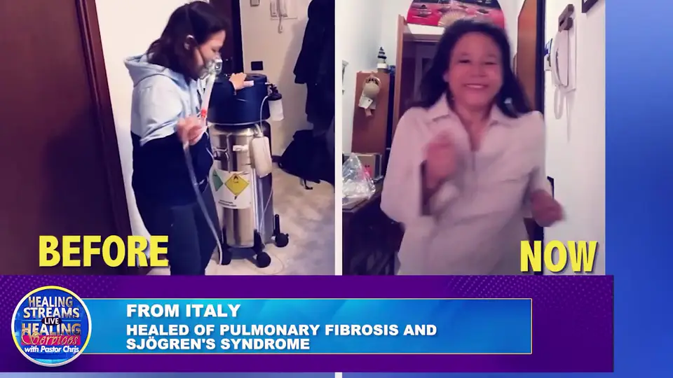 Healed of pulmonary fibrosis and Sjögren’s syndrome